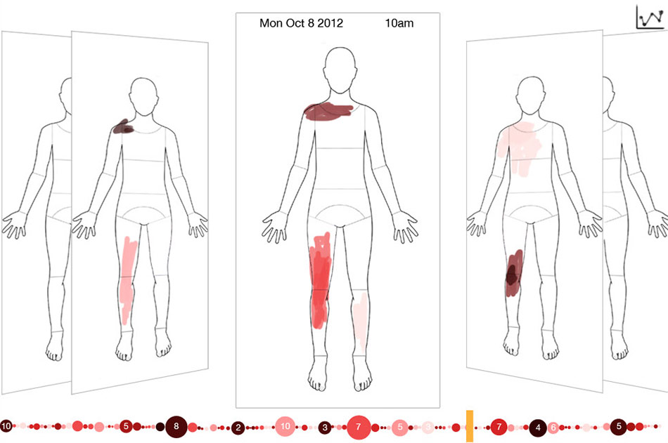 Viewing the history of recorded pain.